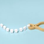 types of tooth extraction, surgical and simple, shown with a wooden model of teeth with pretend pliers