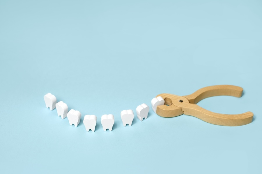 types of tooth extraction, surgical and simple, shown with a wooden model of teeth with pretend pliers